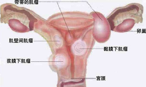 �ӹ���������ô���£�