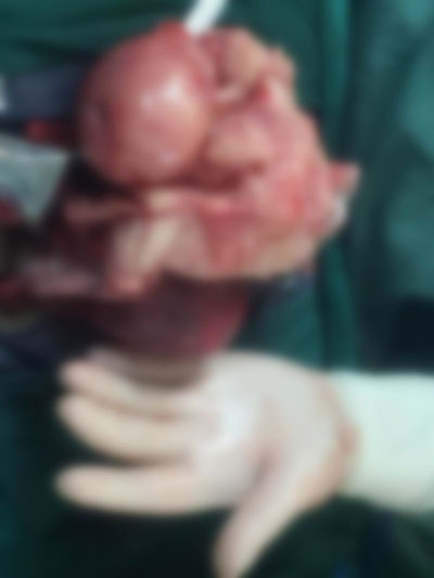 MUP201708151040189636.jpg