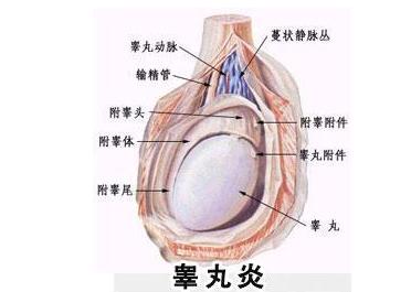 睾丸炎怎么自我诊断