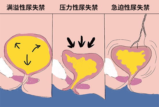 ʰҽԺ