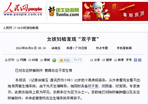 <em>女孩妇检</em>发现双子宫-广州仁爱医院动态